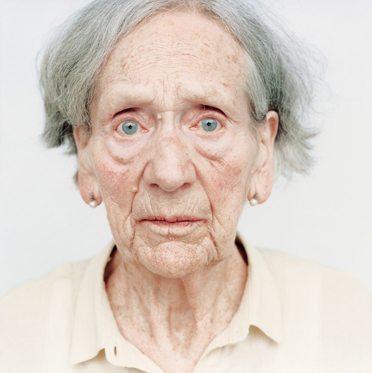 Возрастная деменция. Лицо человека с Альцгеймером. Лица больных Альцгеймера. Лицо человека с деменцией.